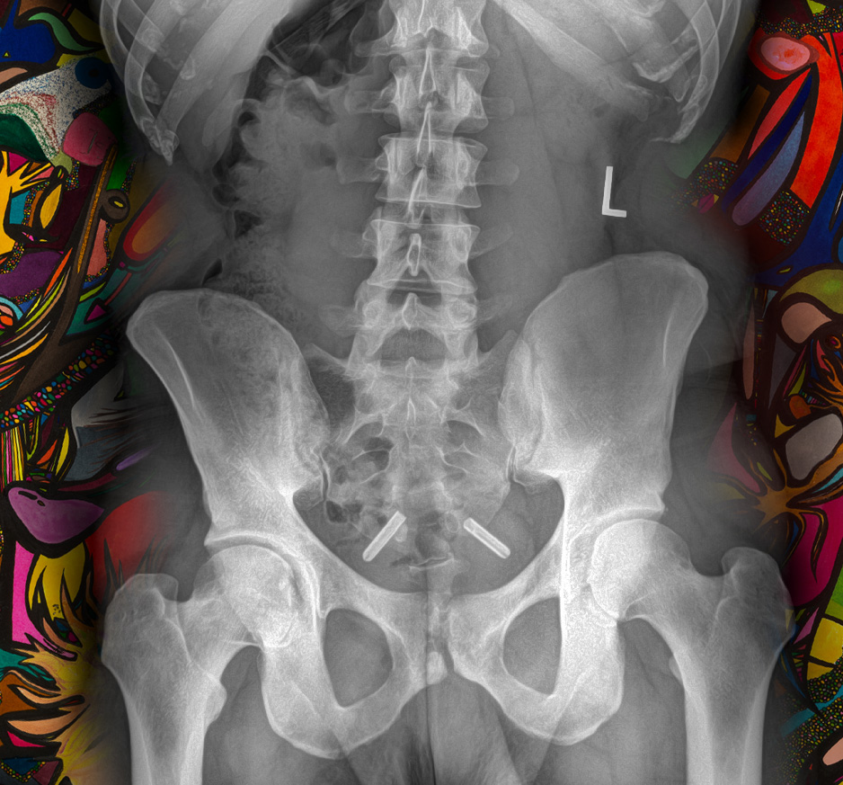 Honest X-Ray Service Michigan