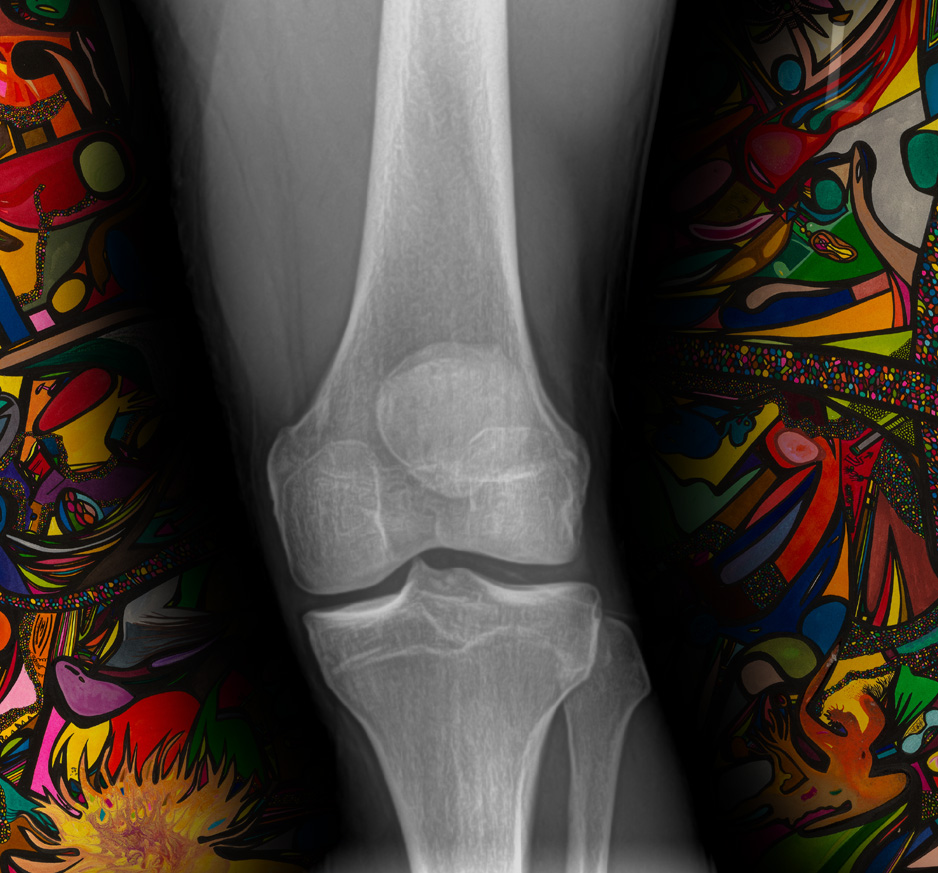 Michigan X-Ray Best Price